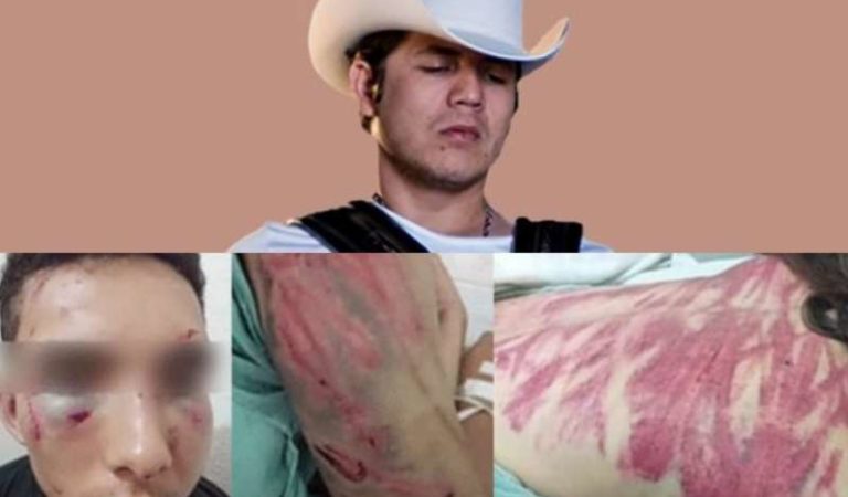 Katy, víctima de Remmy Valenzuela, narra como fue golpeada | imágenes muy fuertes